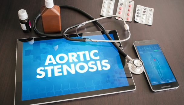 Aortic,Stenosis,(heart,Disorder),Diagnosis,Medical,Concept,On,Tablet,Screen