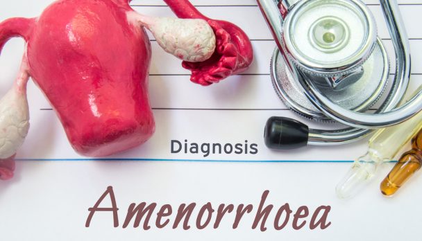 Diagnosis,Of,Amenorrhea.,Medical,History,Of,Patient,With,Diagnosis,Of